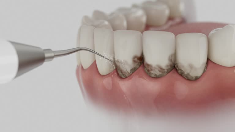 Trusted Dental Crowns And Bridges service in Wendell, NC - Dentist Open Now